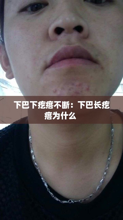 飞扬跋扈 第3页